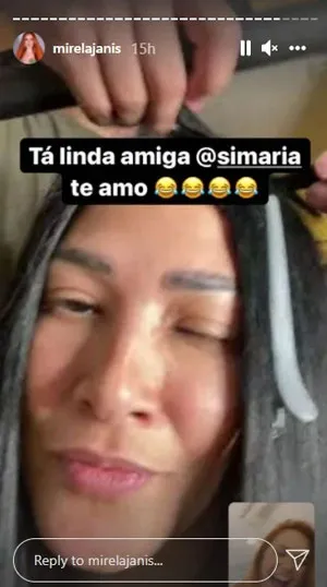 Simaria é atacada por abelha e fica irreconhecível; veja!