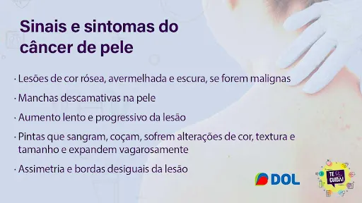 Dezembro laranja: especialista alerta sobre o câncer de pele