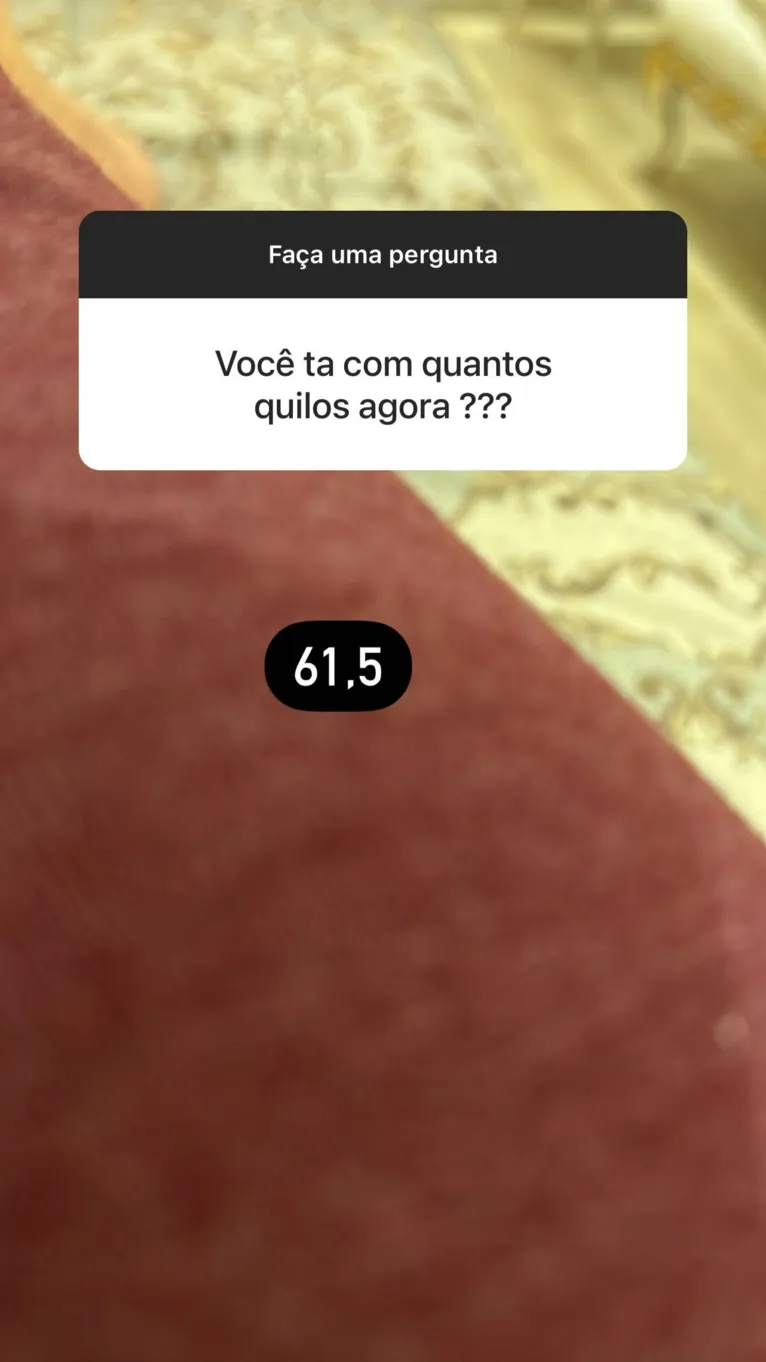 Simone perde mais de 25kg e exibe resultado após cirurgia