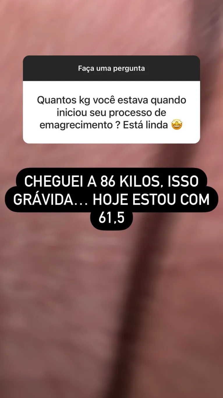 Simone perde mais de 25kg e exibe resultado após cirurgia