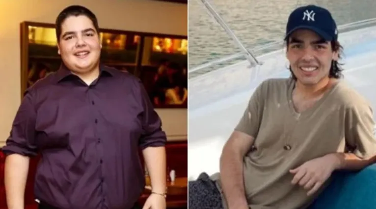 João Guilherme antes e depois da cirurgia bariátrica 