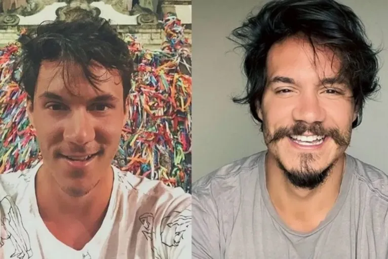 O antes e o depois do participante do BBB. Que tal?
