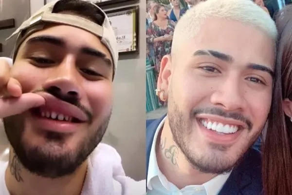 Kevinho foi um que já mostrou os dentes sem porcelana