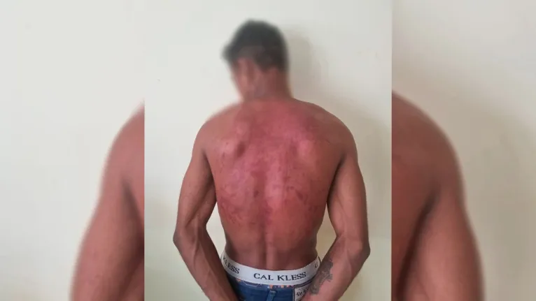 Vítima estava com vários hematomas e ferimentos no corpo 