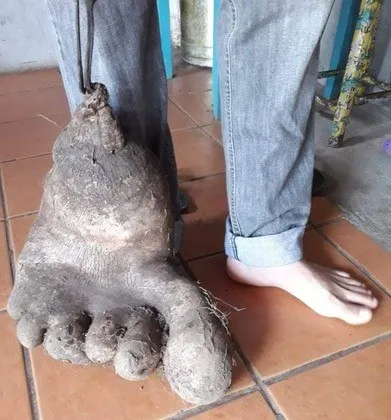 O vegetal de quase 8 kg é na verdade "um tipo de tubérculo de cabaça"