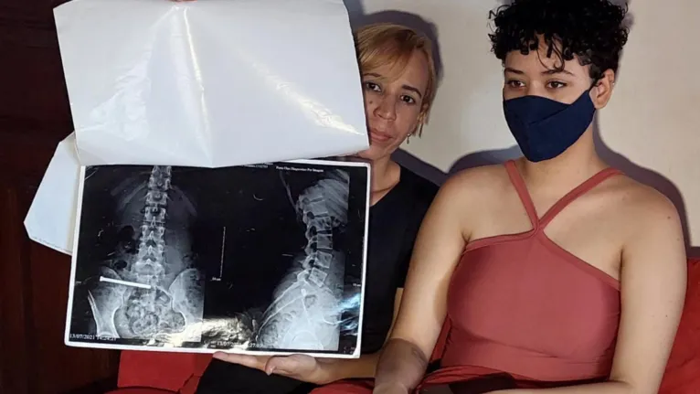 Paraense vítima de acidente no PR pede ajuda para cirurgias