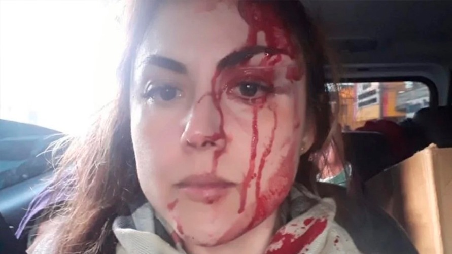 Promotora Gabriela Samadello Monteiro de Barros ficou machucada após a ação violenta