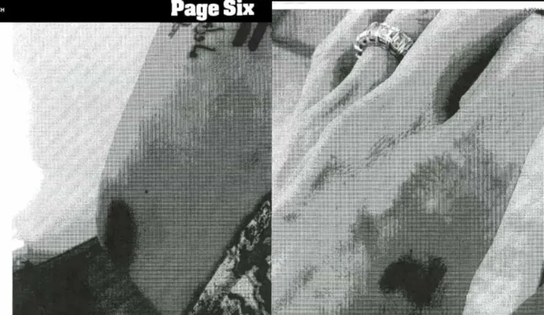 Imagens de ferimentos no cotovelo e na mão foram divulgadas por Angelina Jolie