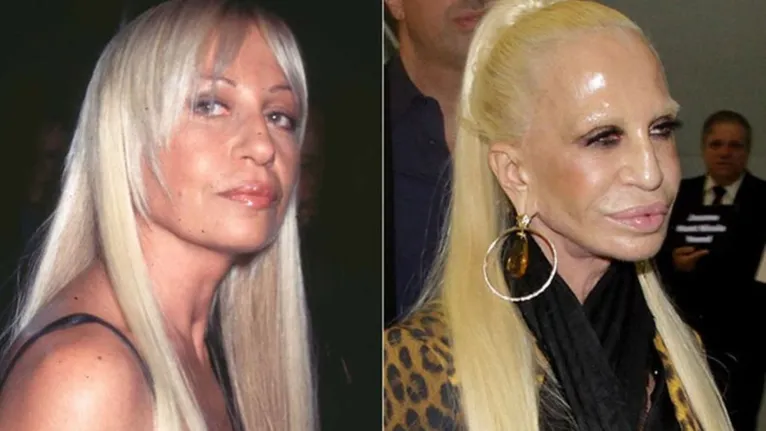 Donatella Versace: quem é, carreira, família, antes e depois