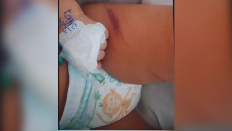 A bebê de 8 meses foi encontrada machucada ao lado do corpo da mãe.