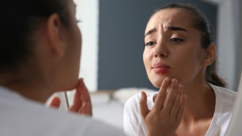 Young woman with herpes on lip looking in mirror at home