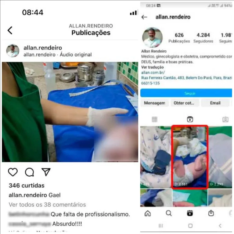Prints do perfil de Allan Rendeiro mostram o vídeo postado pelo médico antes de ser deletado da rede social