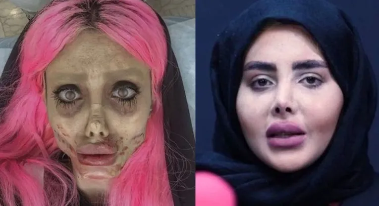 Fatemeh Khishvand com as maquiagens e filtros que a tornaram conhecida e com o rosto verdadeiro após sair da prisão