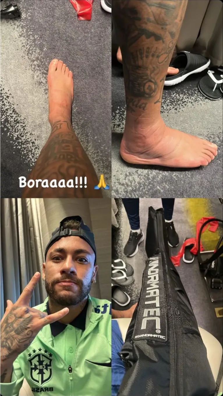 Neymar mostra tratamento da lesão nas redes sociais