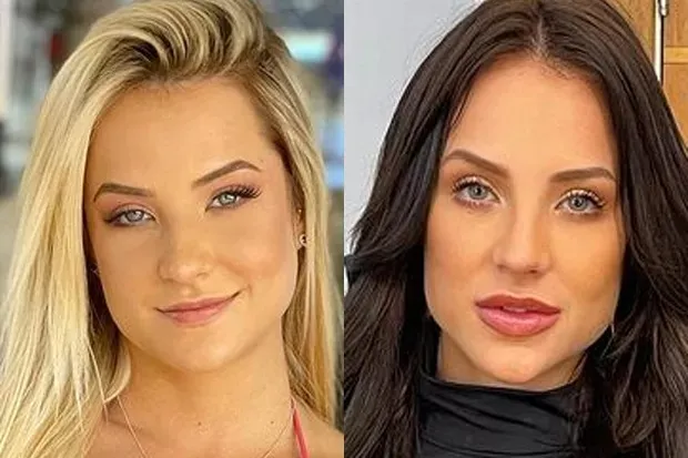 Gabi antes e depois da harmonização