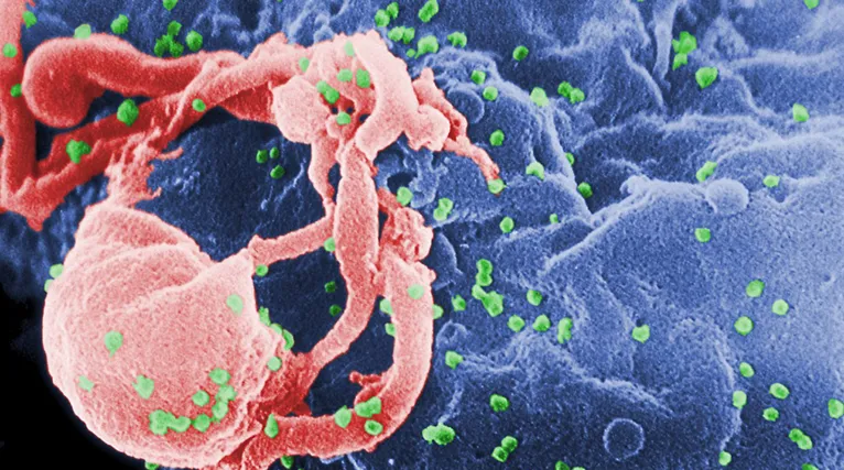 O HIV é silencioso, e pode ficar no organismo em até 15 anos