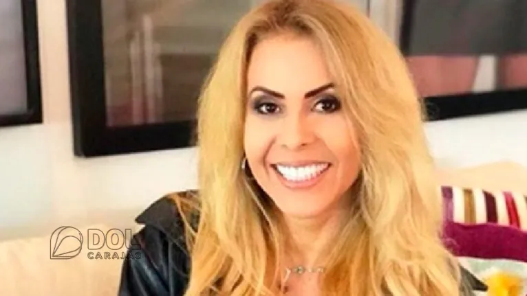 Joelma passou por um procedimento de preenchimento labial e facial juntos