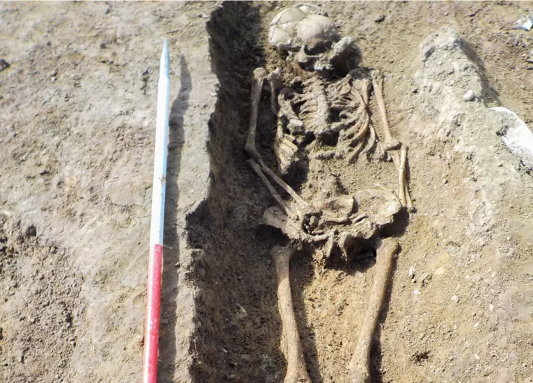 Crânio com estaca de ferro cravado é achado no Reino Unido