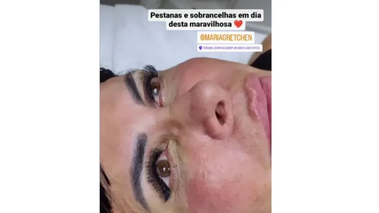 Gretchen faz procedimento no bumbum: veja o resultado