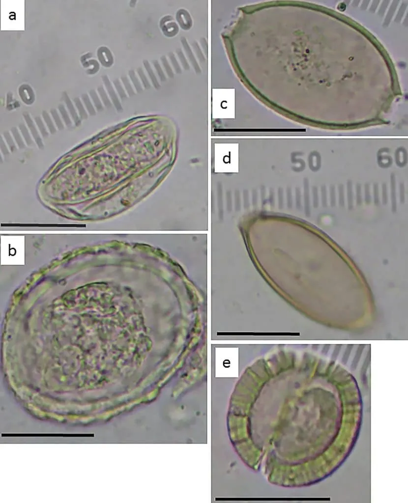 Os ovos fossilizados dos vermes intestinais extraídos de sítio arqueológico em Jerusalém mostram que população da cidade, há 3 mil anos, lidou com um longo surte de doenças.