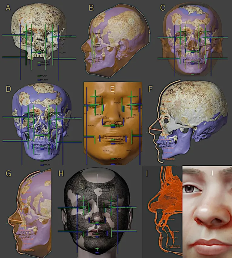 Etapas da aproximação facial digital