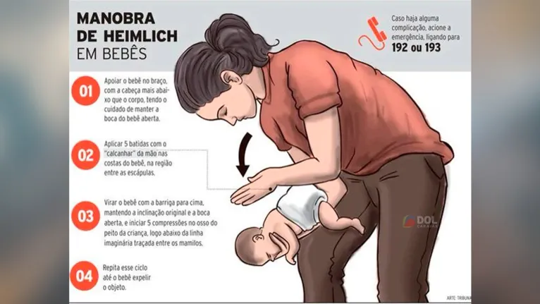 Como salvar um bebe de engasgamento Manobra de Heimlich