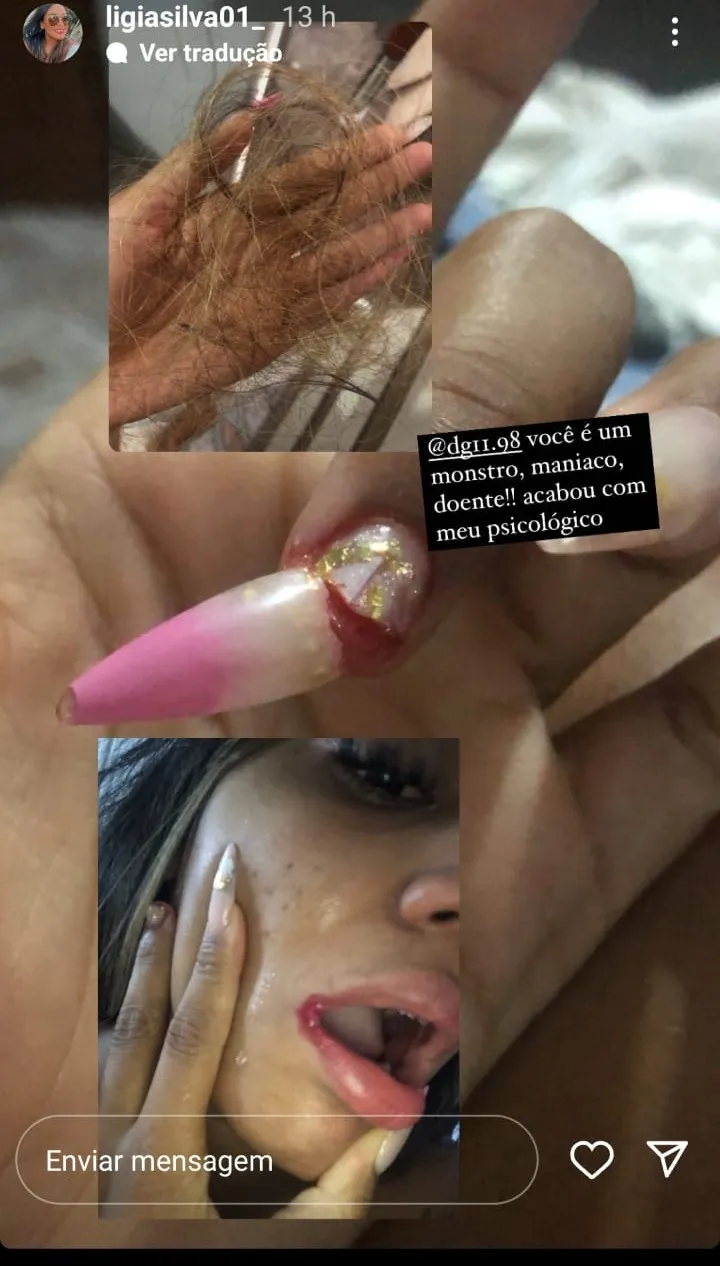 Vítima relatou que teve o cabelo e unhas arrancados, além de ferimentos nos lábios