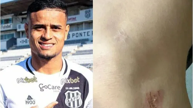 Mulher exibe marcas pelo corpo. Segundo ela, a agressão foi cometida por Everton, que atualmente é jogador da Ponte Preta.