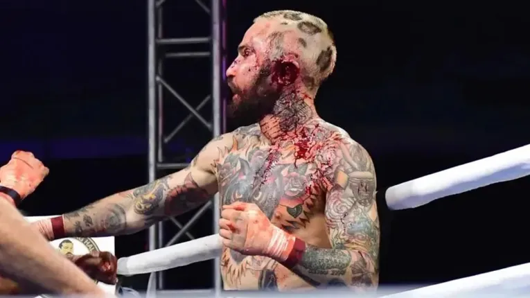 O lutador também sofreu um corte na região profundo na orelha esquerda.