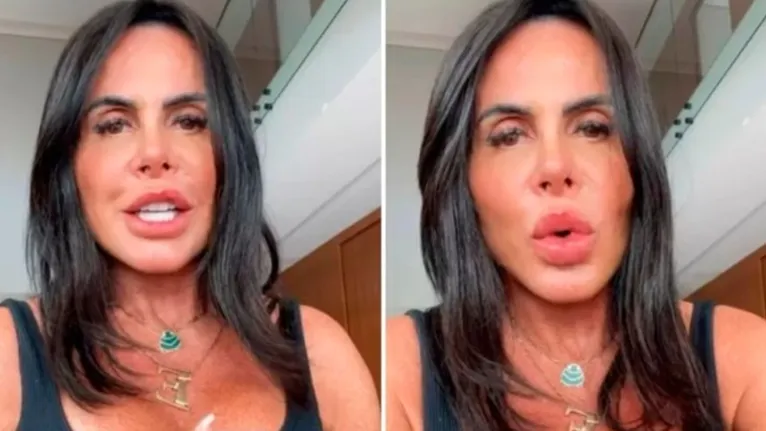 Gretchen explicou novo procedimento que deixou rosto mais 'fino e delicado'