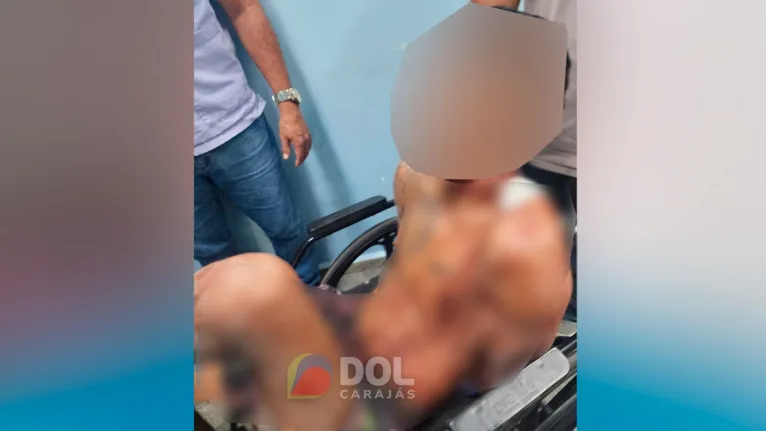 O terceiro suspeito baleado foi levado para o Hospital Municipal de Marabá