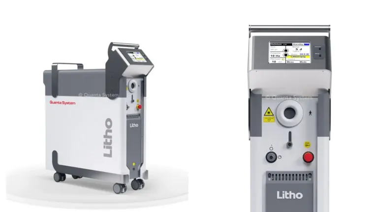O laser “Litho”, da marca Quanta System, é capaz de pulverizar cálculos renais (pedra nos rins) sem necessidade de cortes no paciente