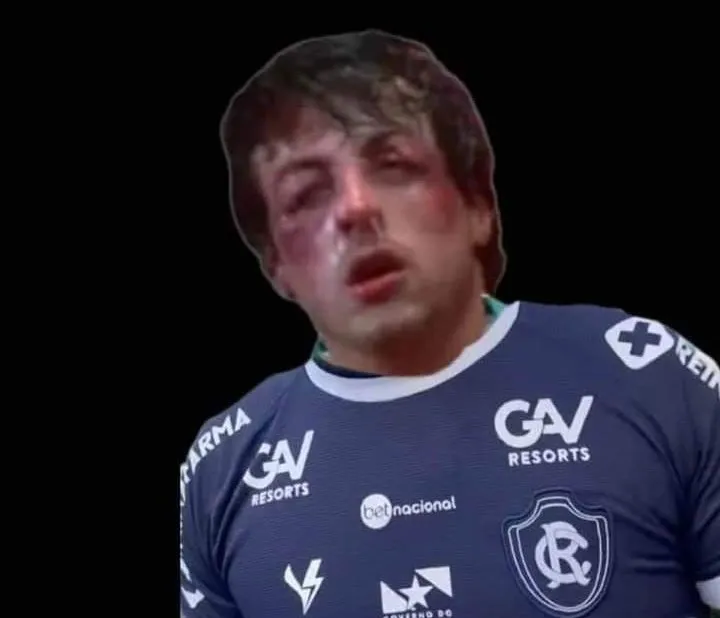 Derrota do Clube do Remo para a Tuna gera onda de memes