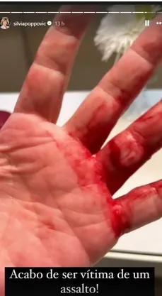 A jornalista foi ferida após ter seu anel roubado durante o assalto.