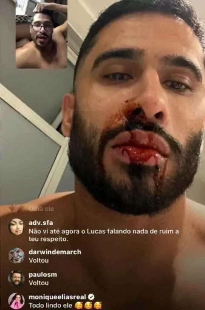 Laéllyo expõe fotos de agressão