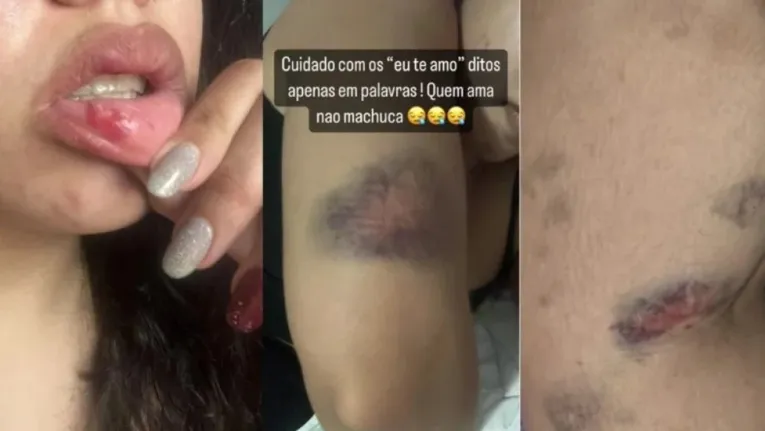 Lutador é preso por agredir a namorada, cantora gospel