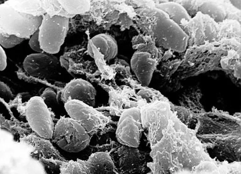 Imagens da bactéria Yersinia pestis causadora da peste negra