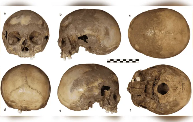 Depois de décadas, Universidade de Viena revisitou o mistério sobre o crânio