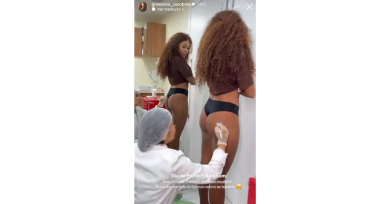 Giovanna, do BBB 25, faz procedimento para aumentar o bumbum