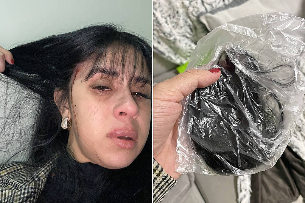A cantora de Blumenau (SC) Débora Amorim, vítima de agressão na semana passada, mostra ferimentos e parte do cabelo cortado
