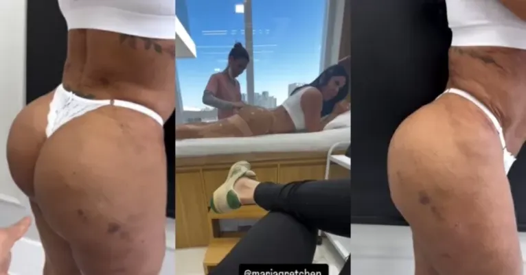 Gretchen mostra harmonização no bumbum e recebe elogios