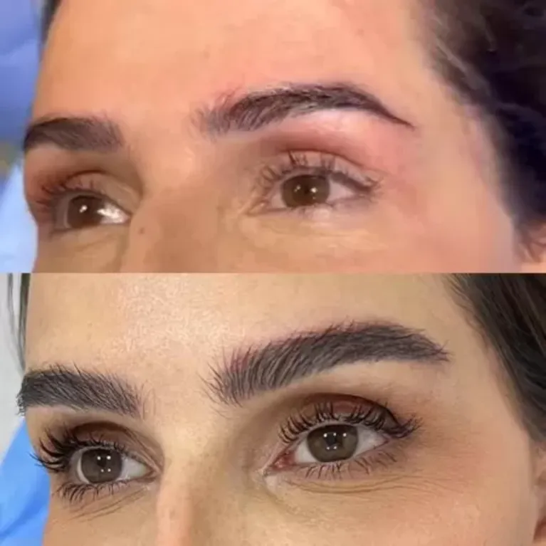 Deborah Secco faz transplante de sobrancelha; veja