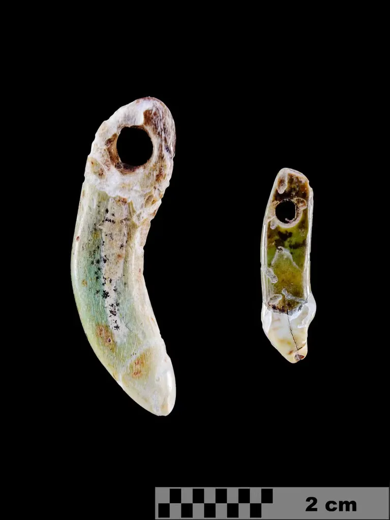 Dentes encontrados apresentam uma descoloração esverdeada.