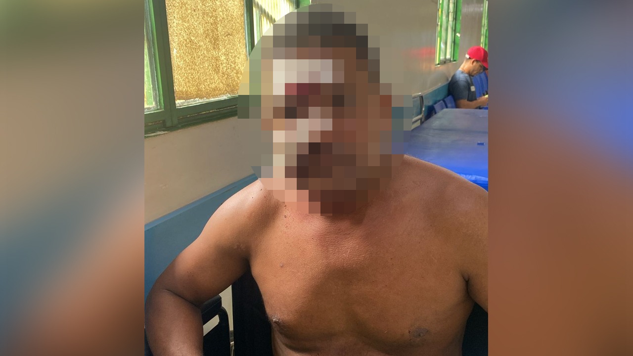 De acordo com a vítima, o atirador se identificou como vizinho e pediu para conversar.
