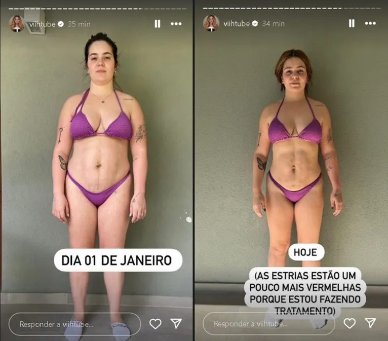 Viih Tube exibe resultado de cirurgias estéticas e comemora: "Me amando"