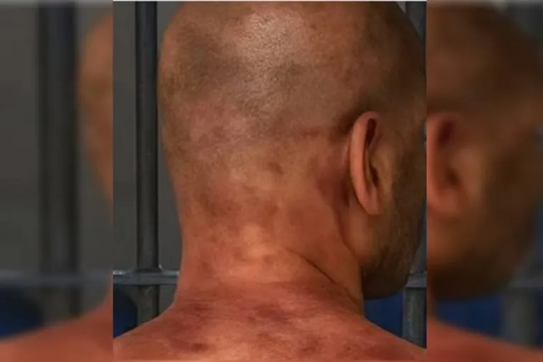 Foto mostra possível agressão a homem que deu 61 socos em ex-namorado no elevador.