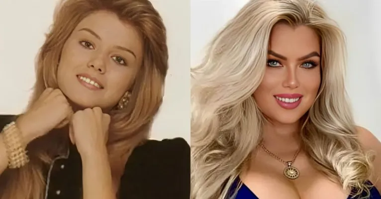 Aos 45 anos, Pat Beijo também ficou famosa por suas diversas cirurgias plásticas e pelo apelido de "Barbie da Vida Real".