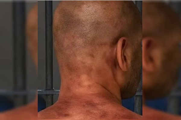 Foto mostra possível agressão a homem que deu 61 socos em ex-namorado no elevador.