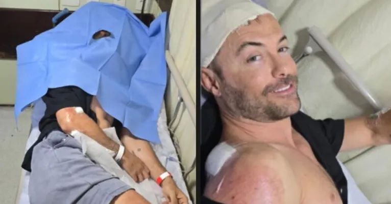 Na hora do acidente, o ator estava sem capacete e acabou batendo a cabeça