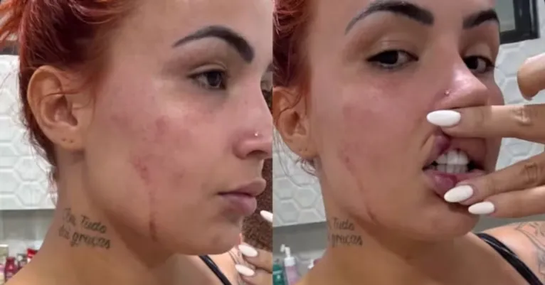 Influenciadora "Ruivinha" é baleada pelo ex durante perseguição
